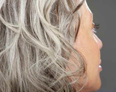 Why do young people have gray hair 01